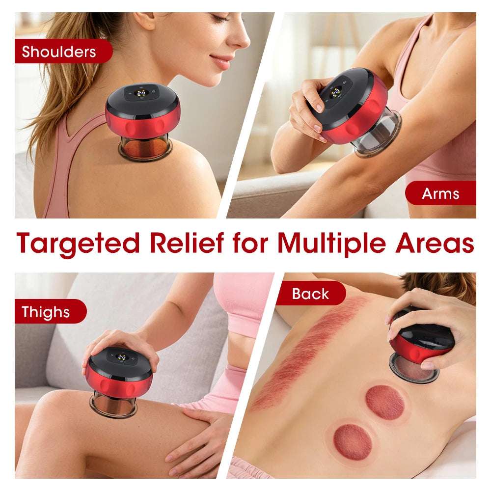 Smart Electric Cupping Massager with Heat & 12 Suction Levels